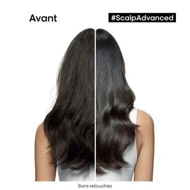 Coffret Apaisant Scalp Advanced de L'Oréal Professionnel