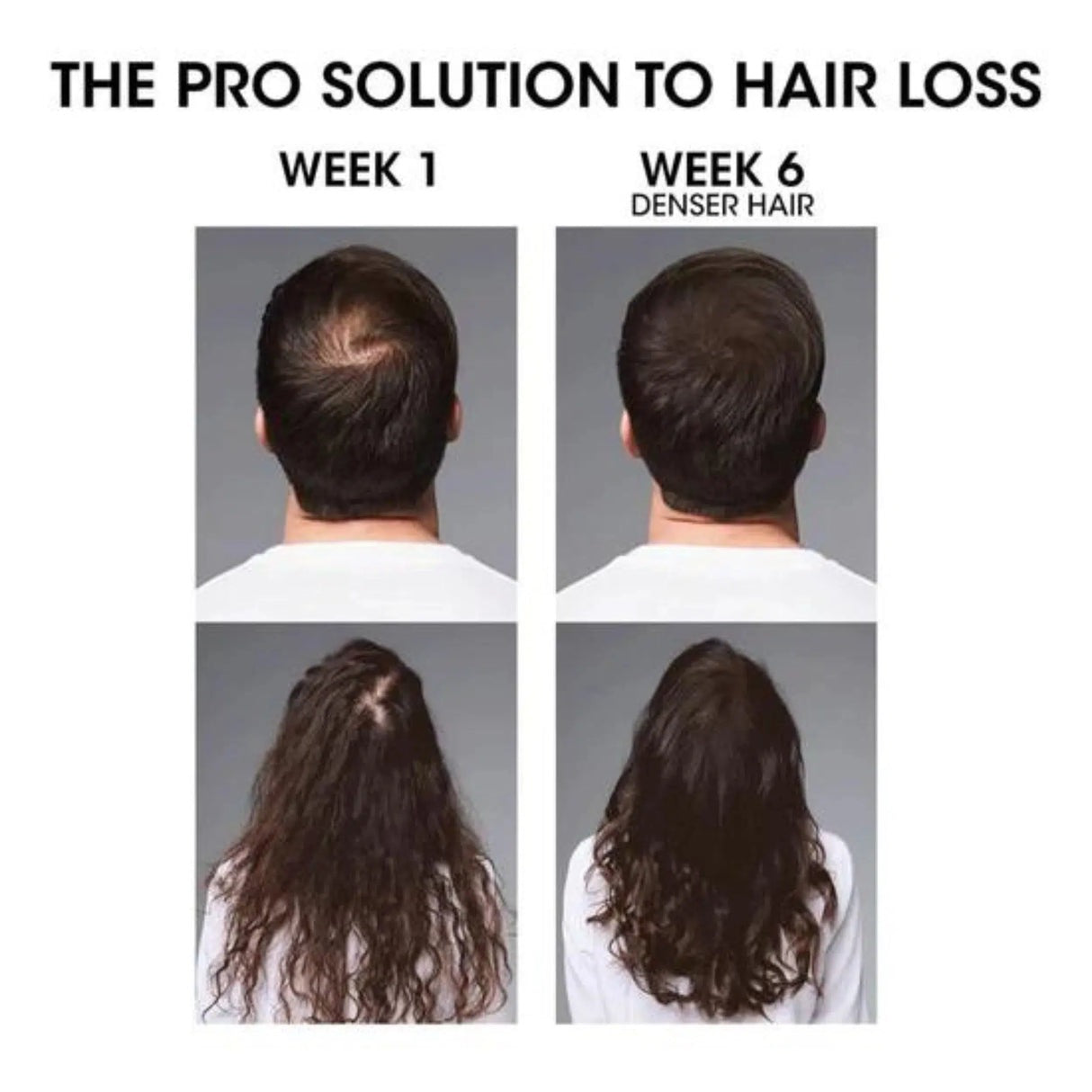 Spray Serioxyl Denser Hair de L’Oréal Professionnel 90ml