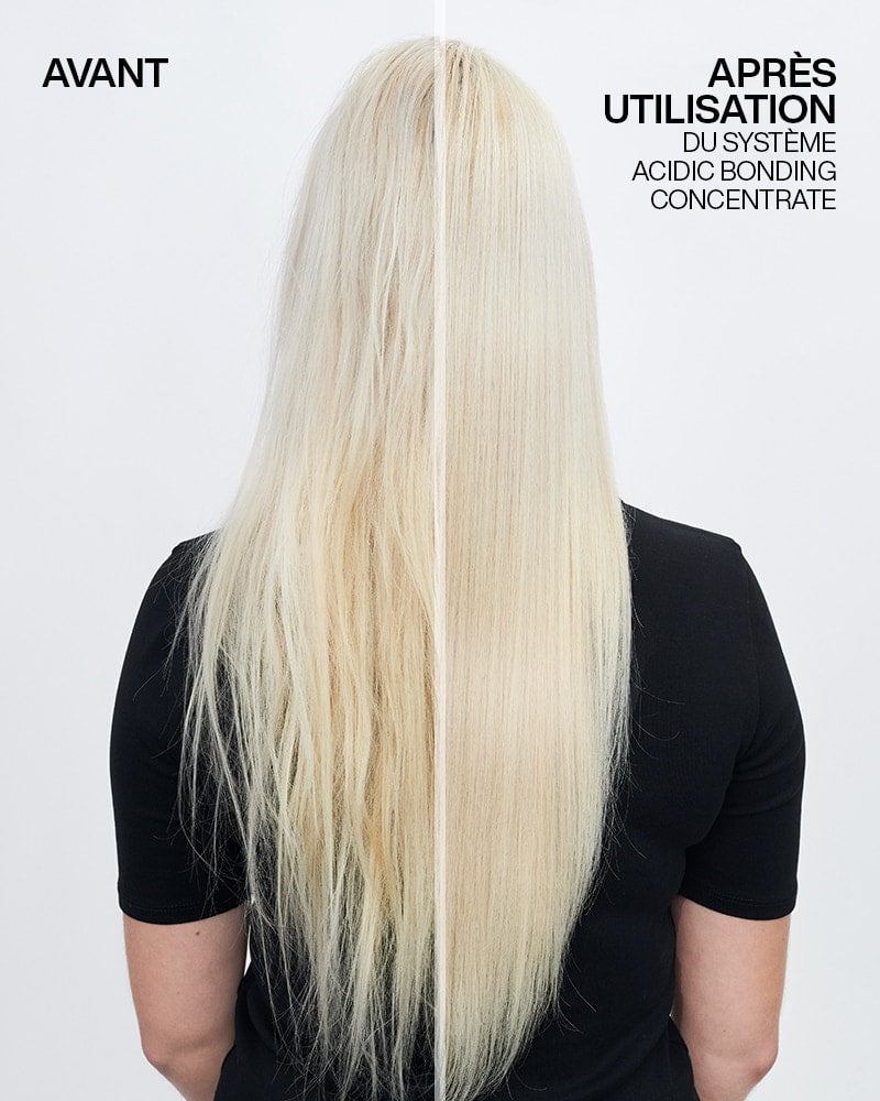 Traitement Sans Rinçage- Acidic Bonding Concentrate