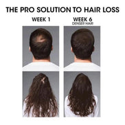 Spray Serioxyl Denser Hair de L’Oréal Professionnel 90ml